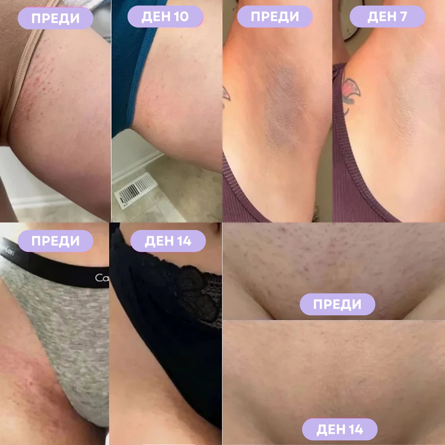 LUMI Серум Против Врастнали Косми